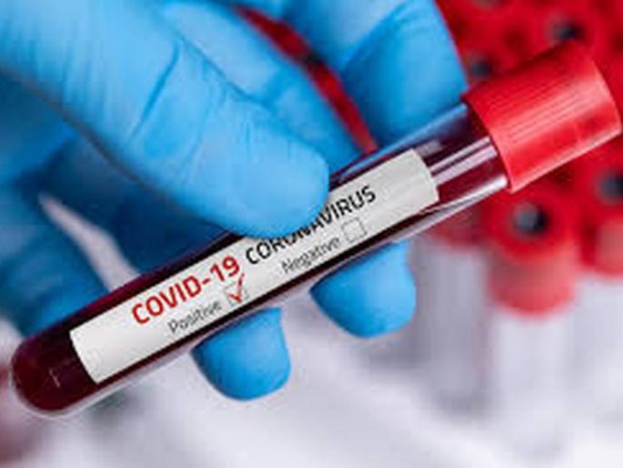 CoronaVirus in Washim: Malegaon woman positive | CoronaVirus in Washim : मालेगावची महिला पॉझिटिव्ह CoronaVirus in Washim: Malegaon woman positive | CoronaVirus in Washim : मालेगावची महिला पॉझिटिव्ह