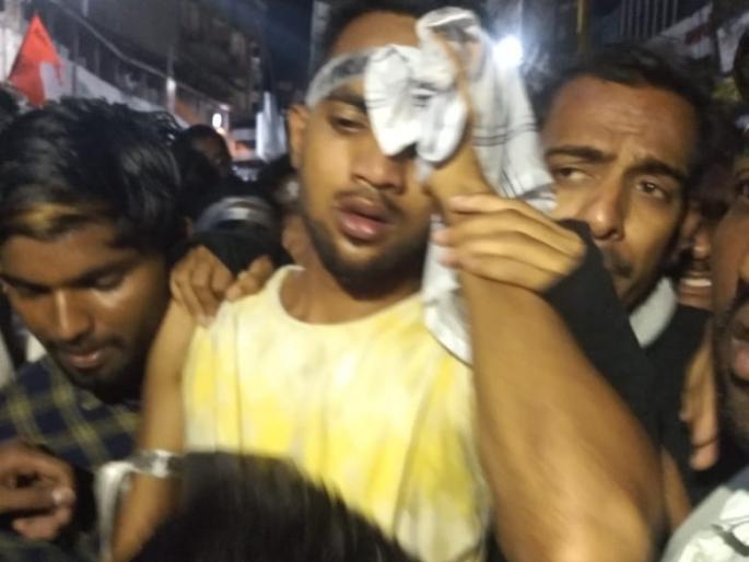 Ganesh Visarjan 2018: Three activists of Praktis Club injured in police raid, injuries stopped | Ganesh Visarjan 2018 : पोलिसांच्या लाठीमारमध्ये ‘प्रॅक्टीस क्लब’ चे तीन कार्यकर्ते जखमी, मिरवणूक थांबली Ganesh Visarjan 2018: Three activists of Praktis Club injured in police raid, injuries stopped | Ganesh Visarjan 2018 : पोलिसांच्या लाठीमारमध्ये ‘प्रॅक्टीस क्लब’ चे तीन कार्यकर्ते जखमी, मिरवणूक थांबली