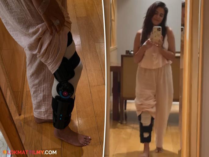 Prarthana Behere had to undergo knee surgery, sharing the post and saying... | प्रार्थना बेहरेच्या गुडघ्याची झाली शस्त्रक्रिया, पोस्ट शेअर करत म्हणाली... Prarthana Behere had to undergo knee surgery, sharing the post and saying... | प्रार्थना बेहरेच्या गुडघ्याची झाली शस्त्रक्रिया, पोस्ट शेअर करत म्हणाली...