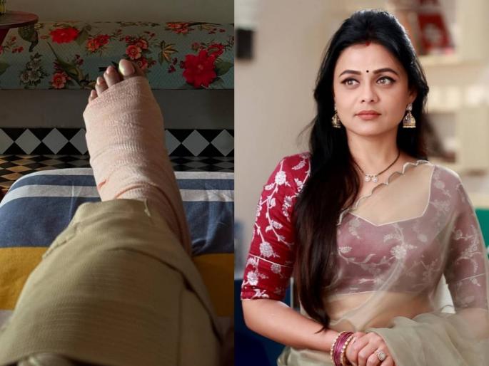 marathi actress prarthana behere knee ligament surgery shared post | प्रार्थना बेहेरेच्या गुडघ्याची झाली सर्जरी, अभिनेत्रीची अशी अवस्था, म्हणाली- "आता काही आठवडे..."