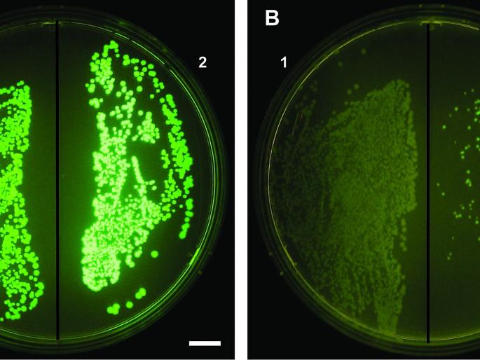 Fluorescent screening methods are now in use in Solapur for the diagnosis of myocardial infarction. | म्युकरमायकोसिसच्या निदानासाठी सोलापुरात आता फ्लोरोसेंट स्क्रिनिंग पध्दती वापरात Fluorescent screening methods are now in use in Solapur for the diagnosis of myocardial infarction. | म्युकरमायकोसिसच्या निदानासाठी सोलापुरात आता फ्लोरोसेंट स्क्रिनिंग पध्दती वापरात