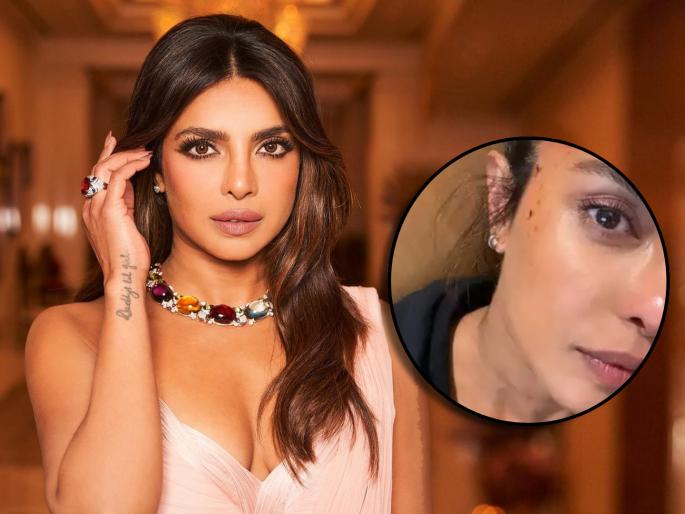 priyanka chopra gets injured while shooting action scenes in head of state movie shared photo | चेहऱ्यावर जखम, रक्त अन्...; प्रियांका चोप्राची अवस्था पाहून चाहते चिंतेत priyanka chopra gets injured while shooting action scenes in head of state movie shared photo | चेहऱ्यावर जखम, रक्त अन्...; प्रियांका चोप्राची अवस्था पाहून चाहते चिंतेत