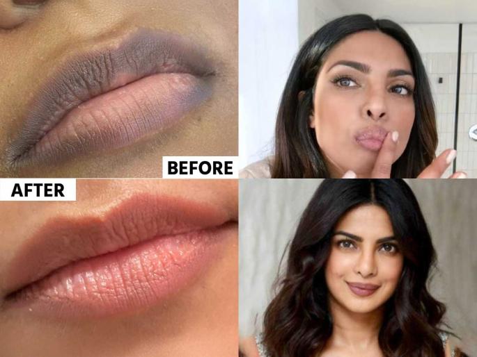 Priyanka Chopra Lip Care Priyanka Chopra Lip Scrub priyanka chopras secret lip scrub | थंडीतही 'देसी गर्ल' प्रियांका चोप्राचे ओठ राहतात मऊमुलायम! करते सैंधव मिठाचा खास उपाय - खुलते सौंदर्य... Priyanka Chopra Lip Care Priyanka Chopra Lip Scrub priyanka chopras secret lip scrub | थंडीतही 'देसी गर्ल' प्रियांका चोप्राचे ओठ राहतात मऊमुलायम! करते सैंधव मिठाचा खास उपाय - खुलते सौंदर्य...