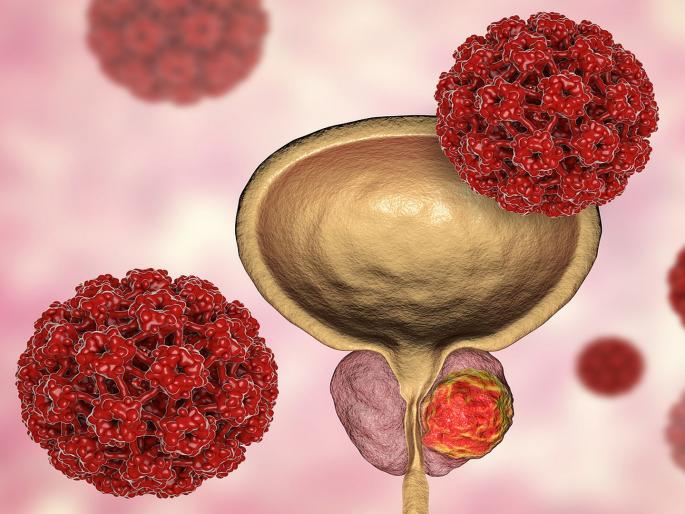 3 food are super effective against prostate cancer | 'हे' ३ फूड्स दूर करू शकतात Prostate cancer चा धोका! 3 food are super effective against prostate cancer | 'हे' ३ फूड्स दूर करू शकतात Prostate cancer चा धोका!