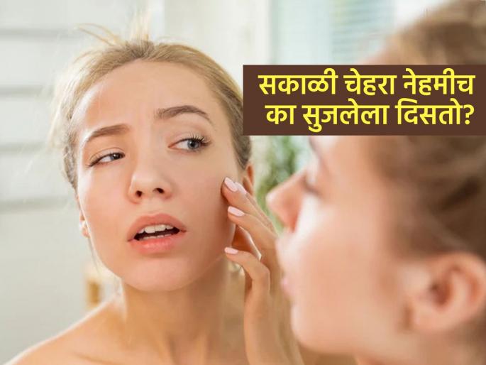 Expert tells the reasons you might be see a puffy face in the morning | रात्री भरपूर झोप घेतल्यावरही सकाळी चेहरा सुजलेला दिसतो? कारणं वाचा, काळजी घ्या...