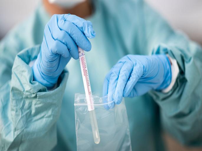 pune city 500 active patients of corona in 5 days covid 19 | Corona Updates: पुणेकरांची चिंता वाढली! शहरात पाच दिवसांत वाढले ५०० सक्रिय रुग्ण pune city 500 active patients of corona in 5 days covid 19 | Corona Updates: पुणेकरांची चिंता वाढली! शहरात पाच दिवसांत वाढले ५०० सक्रिय रुग्ण
