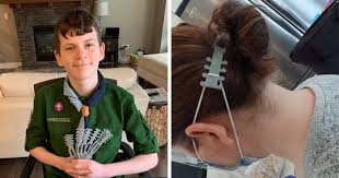 coronavirus : 12 years Boy 3D Prints ‘Ear Guards’ to Help doctors & police. | 12 वर्षा़च्या क्वाईनने बनवले डॉक्टर आणि पोलिसांसाठी हायटेक मास्क !