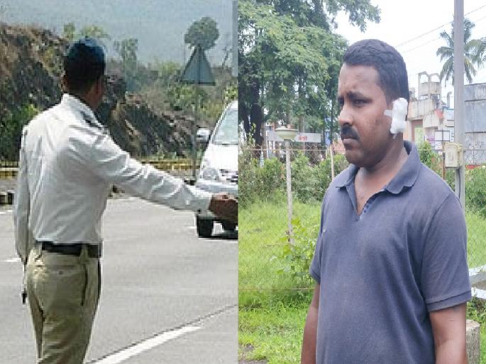 A young man's ear was injured when he was hit by a traffic policeman in ratnagiri | दुचाकीस्वार म्हणाला कारवाई करु नका, रागाने वाहतूक पोलिसाने लगावली कानशिलात; कानाला दुखापत A young man's ear was injured when he was hit by a traffic policeman in ratnagiri | दुचाकीस्वार म्हणाला कारवाई करु नका, रागाने वाहतूक पोलिसाने लगावली कानशिलात; कानाला दुखापत