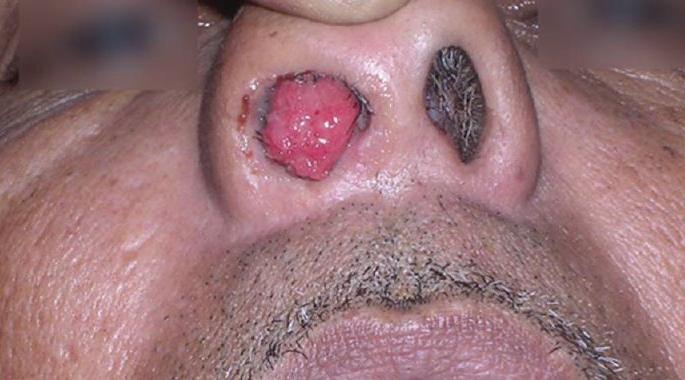 Be careful! Swimming in the pool? May be a threat to parasites! | सावधान! तलावात पोहता? होऊ शकतो परजीवीचा धोका!