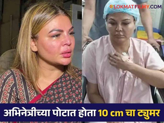 Rakhi Sawant can never be a mother! She said - "There is a lot of pain inside but..." | Rakhi Sawant : राखी सावंत आता कधीच होऊ शकत नाही आई! म्हणाली - "आतून खूप वेदना आहेत पण..." Rakhi Sawant can never be a mother! She said - "There is a lot of pain inside but..." | Rakhi Sawant : राखी सावंत आता कधीच होऊ शकत नाही आई! म्हणाली - "आतून खूप वेदना आहेत पण..."