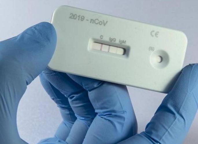 ‘Rapid Test’; Confusion of the health system of the corporation over the number of patients | ‘रॅपिड टेस्ट’; रुग्णांच्या संख्येवरून मनपाच्या आरोग्य यंत्रणेचा गोंधळ ‘Rapid Test’; Confusion of the health system of the corporation over the number of patients | ‘रॅपिड टेस्ट’; रुग्णांच्या संख्येवरून मनपाच्या आरोग्य यंत्रणेचा गोंधळ