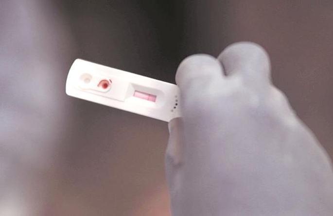 Diagnosis of corona from rapid antigen detection | रॅपिड अँटीजन तपासणीतून कोरोनाचे निदान Diagnosis of corona from rapid antigen detection | रॅपिड अँटीजन तपासणीतून कोरोनाचे निदान