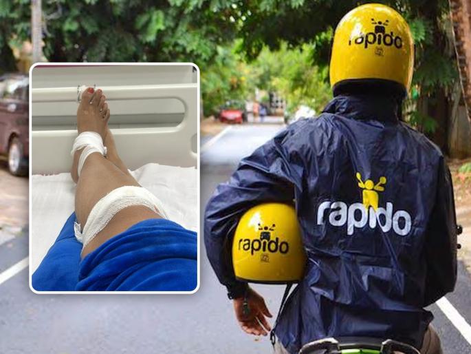 girl shares horrifying story about reckless driver never taking rapido bike again | "मी रॅपिडो कधीच बुक करणार नाही"; अपघातानंतर ड्रायव्हर पळाला, तरुणीने सांगितली आपबीती