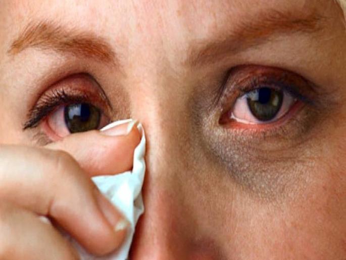 Marburg Virus causes symptoms prevention treatment | अरे बापरे! लोकांच्या डोळ्यातून येतंय रक्त; खतरनाक इबोलासारखा जीवघेणा आहे 'हा' व्हायरस Marburg Virus causes symptoms prevention treatment | अरे बापरे! लोकांच्या डोळ्यातून येतंय रक्त; खतरनाक इबोलासारखा जीवघेणा आहे 'हा' व्हायरस