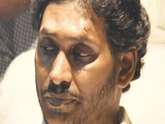 Andhra CM Jagan Mohan Reddy injured in stone pelting incident in Vijayawada | मोठी बातमी! आंध्र प्रदेशचे मुख्यमंत्री जगन रेड्डी यांच्या रॅलीवर दगडफेक; रुग्णालयात दाखल Andhra CM Jagan Mohan Reddy injured in stone pelting incident in Vijayawada | मोठी बातमी! आंध्र प्रदेशचे मुख्यमंत्री जगन रेड्डी यांच्या रॅलीवर दगडफेक; रुग्णालयात दाखल