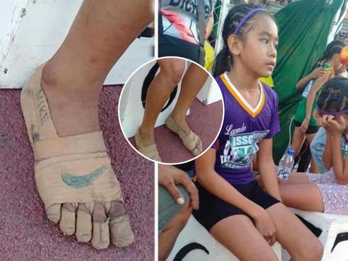 Philippines girl, 11 years old, rhea bullos run barefoot with bandage- viral | पायाला बँण्डेज बांधून शर्यतीत धावली ११ वर्षांची फिलिपिनो मुलगी; अनवाणी पायांची जिद्द नेमकी काय सांगते?