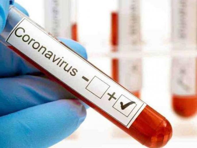 How did this happen .... swab not given, still report corona positive | हे कसे घडले....स्वॅब दिला नाही, तरीही रिपोर्ट कोरोना पॉझिटिव्ह How did this happen .... swab not given, still report corona positive | हे कसे घडले....स्वॅब दिला नाही, तरीही रिपोर्ट कोरोना पॉझिटिव्ह