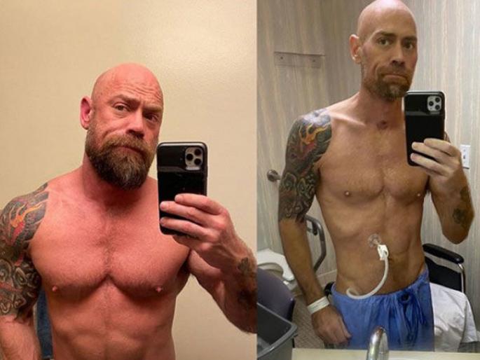 America nurse shares shocking pics of before and after Covid-19 effect on body api | Coronavirus : बघा कोरोनाने काय केली या पुरूष नर्सची स्थिती, फोटो पाहून विश्वास बसणार नाही! America nurse shares shocking pics of before and after Covid-19 effect on body api | Coronavirus : बघा कोरोनाने काय केली या पुरूष नर्सची स्थिती, फोटो पाहून विश्वास बसणार नाही!