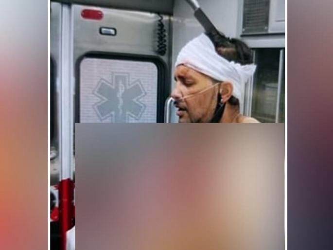 A 36 year old man was stabbed street harlem nyc america, video goes viral | धक्कादायक! डोक्यात घुसलेल्या चाकूसोबत तो रस्त्यावर फिरत होता, व्हिडीओ सोशल मीडियावर व्हायरल... A 36 year old man was stabbed street harlem nyc america, video goes viral | धक्कादायक! डोक्यात घुसलेल्या चाकूसोबत तो रस्त्यावर फिरत होता, व्हिडीओ सोशल मीडियावर व्हायरल...