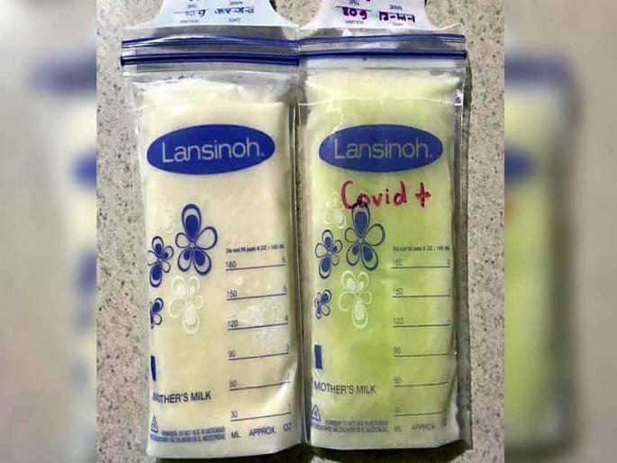 Mother breast milk turned neon green after corona infection at science | आश्चर्य! कोरोना व्हायरसमुळे महिलेच्या दुधाचा रंग झाला हिरवा, डॉक्टरही झाले हैराण....