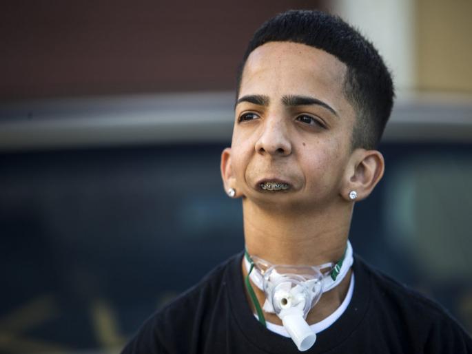 Meet this boy Isaiah Acosta who born without jaw today he is rap star | लढाई जगण्याची! विना जबड्याचा जन्माला आला हा मुलगा, व्यंगावर मात देत आज बनला आहे मोठा स्टार... Meet this boy Isaiah Acosta who born without jaw today he is rap star | लढाई जगण्याची! विना जबड्याचा जन्माला आला हा मुलगा, व्यंगावर मात देत आज बनला आहे मोठा स्टार...