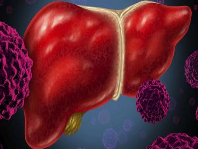 Obesity and diabetes major risk factor for non alcoholic fatty liver disease | सावधान! दारू न पिणाऱ्यांचंही लिवर होऊ शकतं खराब, जाणून घ्या कारण...