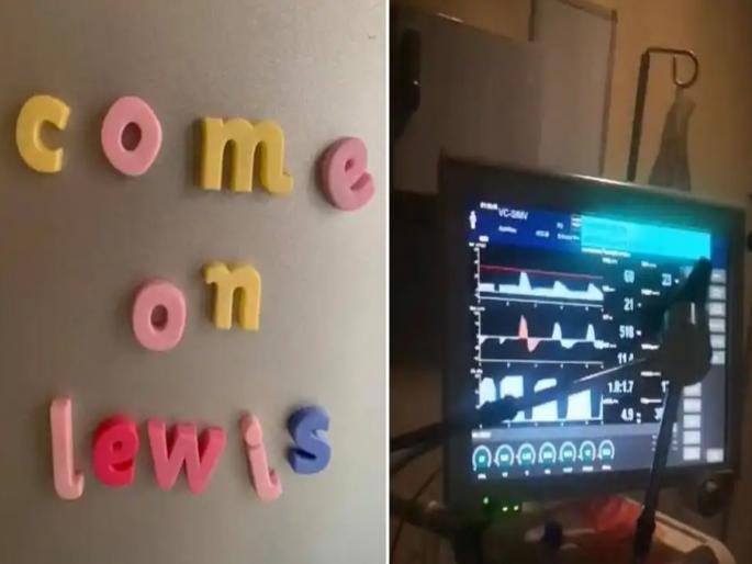 England brain dead teenager wakes up just hours before organ donation | चमत्कार! अवयव दानाची सुरू होती तयारी, तेव्हाच मृत घोषित तरूण घेऊ लागला श्वास; डॉक्टर हैराण.. England brain dead teenager wakes up just hours before organ donation | चमत्कार! अवयव दानाची सुरू होती तयारी, तेव्हाच मृत घोषित तरूण घेऊ लागला श्वास; डॉक्टर हैराण..