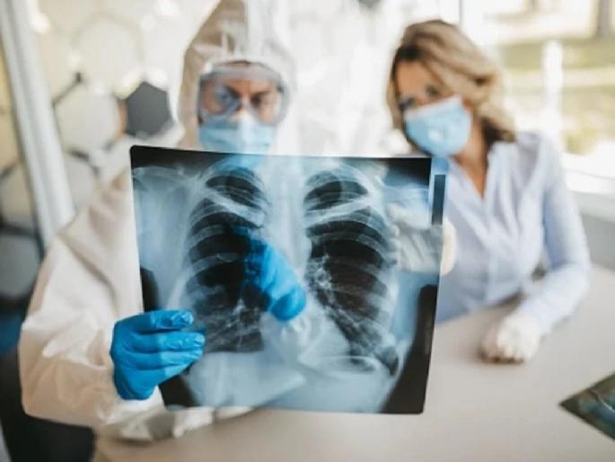 Coronavirus New Symptoms : Happy Hypoxia became dangerous for covid patients covid 19 treatment | Happy Hypoxia Symptoms : जीवघेणं ठरत आहे कोरोनाचं नवं लक्षण 'हॅप्पी हायपोक्सिया', जाणून घ्या नेमकं काय होतं.... Coronavirus New Symptoms : Happy Hypoxia became dangerous for covid patients covid 19 treatment | Happy Hypoxia Symptoms : जीवघेणं ठरत आहे कोरोनाचं नवं लक्षण 'हॅप्पी हायपोक्सिया', जाणून घ्या नेमकं काय होतं....