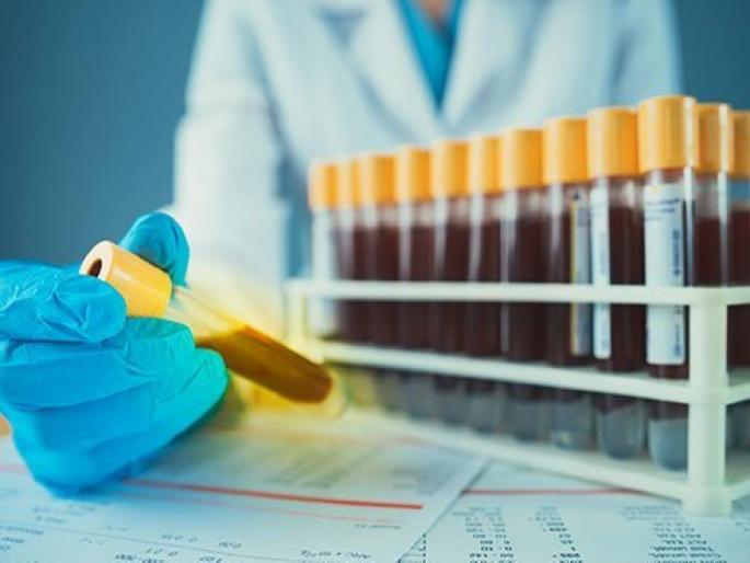 Interesting facts about golden blood is rarest blood group in the world | हा आहे जगातला सर्वात दुर्मीळ ब्लड ग्रुप, जगभरात केवळ ४३ लोकांमध्ये आढळतं हे ब्लड Interesting facts about golden blood is rarest blood group in the world | हा आहे जगातला सर्वात दुर्मीळ ब्लड ग्रुप, जगभरात केवळ ४३ लोकांमध्ये आढळतं हे ब्लड