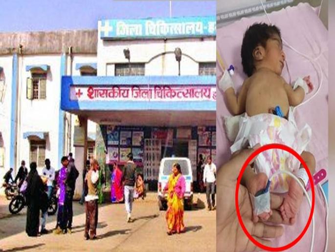 MP : Girl born with inverted legs in Harda parents left her in hospital | धक्कादायक! उलट्या पायांसोबत जन्माला आली चिमुकली, आई-वडील हॉस्पिटलमध्ये सोडून फरार! MP : Girl born with inverted legs in Harda parents left her in hospital | धक्कादायक! उलट्या पायांसोबत जन्माला आली चिमुकली, आई-वडील हॉस्पिटलमध्ये सोडून फरार!