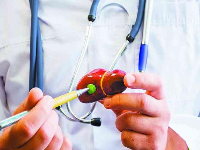 Don't ignore the gallbladder problem, it will be expensive ... see what the doctor says | पित्ताशयाच्या समस्येकडे करू नका दुर्लक्ष, पडेल महागात...बघा डॉक्टर काय सांगतात