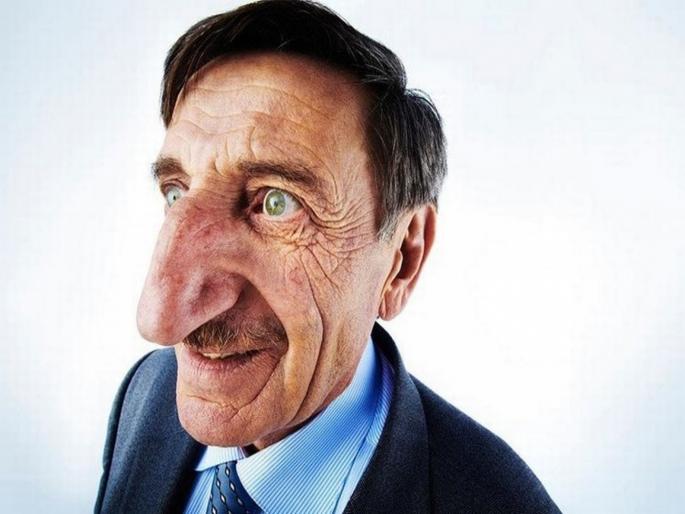 Turkish man has worlds longest nose and its getting bigger | 'या' व्यक्तीला आहे जगात सर्वात लांब नाक, अजूनही रोज वाढत आहे साइज Turkish man has worlds longest nose and its getting bigger | 'या' व्यक्तीला आहे जगात सर्वात लांब नाक, अजूनही रोज वाढत आहे साइज