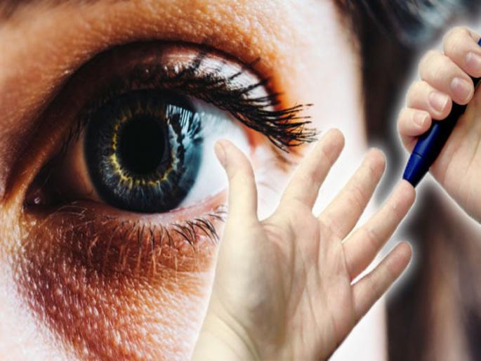 Diabetes warning signs you can spot in your eyes | Diabetes चा इशारा देतं डोळ्यात दिसणारं हे लक्षण, ओळखा आणि वेळीच व्हा सावध Diabetes warning signs you can spot in your eyes | Diabetes चा इशारा देतं डोळ्यात दिसणारं हे लक्षण, ओळखा आणि वेळीच व्हा सावध