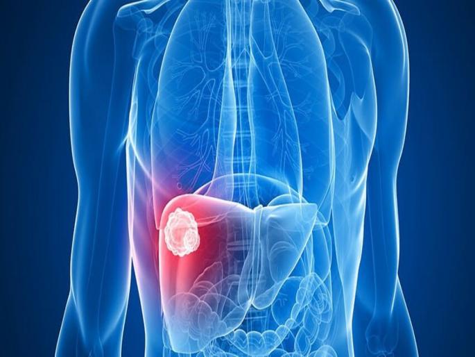 Liver Cancer : Junk food cause liver cancer or fatty liver | Liver Cancer : 'या' एका पदार्थाने वाढतो लिव्हर कॅन्सरचा धोका, आजपासूनच खाणं करा बंद Liver Cancer : Junk food cause liver cancer or fatty liver | Liver Cancer : 'या' एका पदार्थाने वाढतो लिव्हर कॅन्सरचा धोका, आजपासूनच खाणं करा बंद