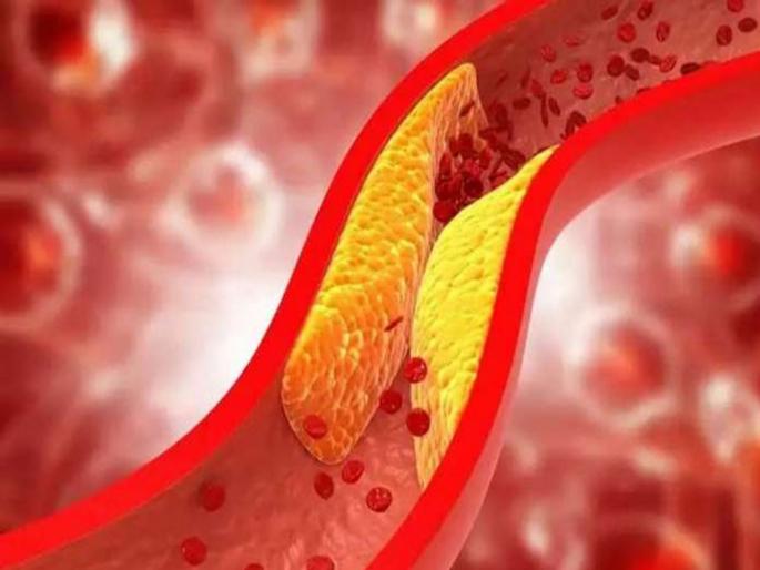 High cholesterol dry skin in this area could be a sign of high levels | High cholesterol: शरीराच्या या भागावरील त्वचा कोरडी झालीये का? समजून घ्या वाढलं आहे कोलेस्ट्रॉल High cholesterol dry skin in this area could be a sign of high levels | High cholesterol: शरीराच्या या भागावरील त्वचा कोरडी झालीये का? समजून घ्या वाढलं आहे कोलेस्ट्रॉल