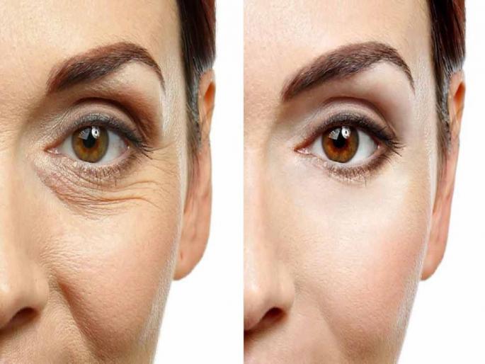 Skin care tips : These foods make you old before age | Skin Care Tips: वेळेआधीच तुम्हाला वृद्ध बनवतात हे पदार्थ, लगेच खाणं करा बंद Skin care tips : These foods make you old before age | Skin Care Tips: वेळेआधीच तुम्हाला वृद्ध बनवतात हे पदार्थ, लगेच खाणं करा बंद