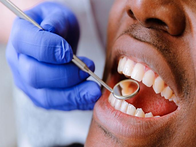 Research poor oral health increases liver cancer risk by up to 75 percent | दात सडले तर होऊ शकतो जीवाला धोका, 75 टक्के वाढतो लिव्हर कॅन्सरचा धोका Research poor oral health increases liver cancer risk by up to 75 percent | दात सडले तर होऊ शकतो जीवाला धोका, 75 टक्के वाढतो लिव्हर कॅन्सरचा धोका
