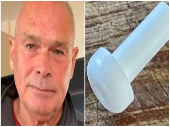 Earbud stuck in ear for 5 years man faced problem in hearing | 5 वर्ष कानात अडकून राहिला इअरबड, जाणून घ्या कसा झाला खुलासा Earbud stuck in ear for 5 years man faced problem in hearing | 5 वर्ष कानात अडकून राहिला इअरबड, जाणून घ्या कसा झाला खुलासा