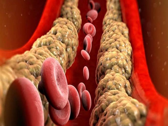 High Cholesterol control tips measures and remedies | हाय कोलेस्ट्रॉल कमी करण्यासाठी सकाळी या पदार्थांच करा सेवन, मग बघा कमाल... High Cholesterol control tips measures and remedies | हाय कोलेस्ट्रॉल कमी करण्यासाठी सकाळी या पदार्थांच करा सेवन, मग बघा कमाल...