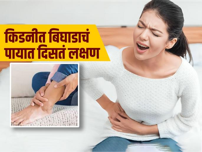Kidney damaged symptoms appear in the legs while you resting | किडनीचं काम बिघडलं की पायांचं तंत्रही बिघडतं, पायांवर दिसतात ‘ही’ लक्षणं, दुर्लक्ष करुच नका..
