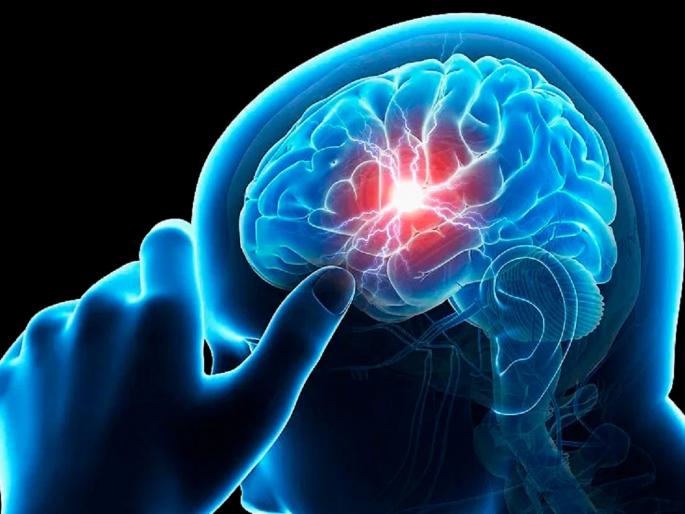 ‘World Stroke Day’: What you need to know to stay healthy in covid-19 period | ‘जागतिक स्ट्रोक दिन’: कोरोनाकाळात निरोगी राहण्यासाठी माहीत असायलाच हव्यात स्ट्रोकबाबत या गोष्टी ‘World Stroke Day’: What you need to know to stay healthy in covid-19 period | ‘जागतिक स्ट्रोक दिन’: कोरोनाकाळात निरोगी राहण्यासाठी माहीत असायलाच हव्यात स्ट्रोकबाबत या गोष्टी