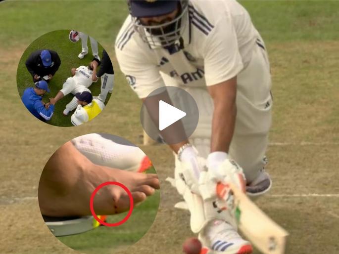 England vs India, 4th Test Rishab Pant Injured Again He Driven Off The Field After Suffering Swelling On His Right Foot And Ravindra Jadeja Walks Out To Middle Watch | बापरे! टीम इंडियाला मोठा धक्का; उलटा फटका मारताना पंतला दुखापत; लंगडत लंगडत सोडलं मैदान (VIDEO)