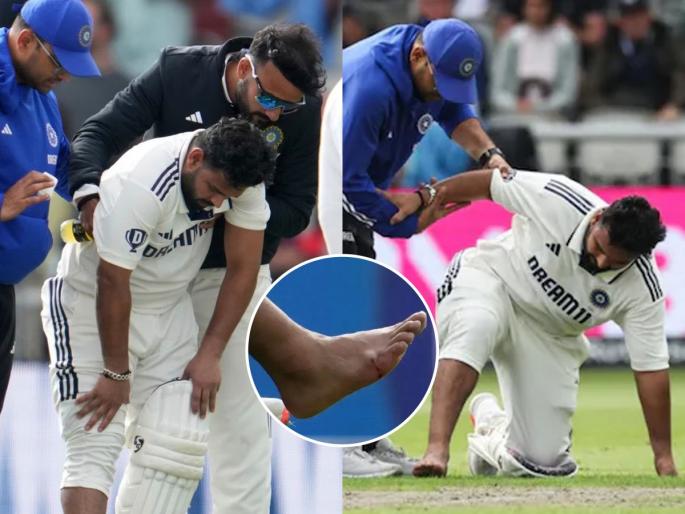 rishabh pant injury played despite a fractured leg Comeback Inspiring Cricket inspirational stories Mental health Strength | मन के जीते जीत है, मन के हारे हार! पाय फ्रॅक्चर होऊनही ऋषभ पंत खेळला, ते कसं जमलं?