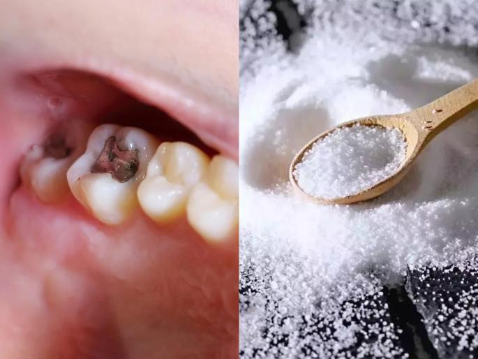 Tooth Cavity Home remedies Garlic And Salt For Tooth Cavity Effective Home Remedies For Tooth Cavities | दातांना कीड लागली? चिमूटभर मिठात ‘हा’ पदार्थ मिसळून लावा, दात दुखणं- दुर्गंध होईल कमी