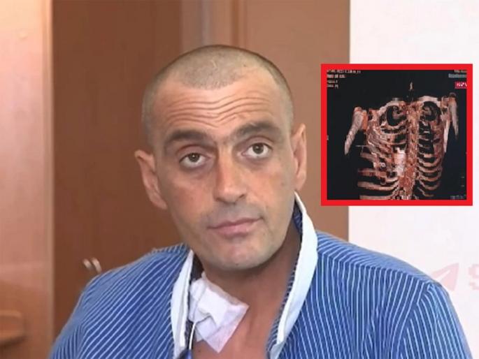 Russia-Ukraine War: 'Live Bomb' Found in Russian Soldier's Chest, Even Doctors Confused | Russia-Ukraine War: रशियन सैनिकाच्या छातीत आढळला 'जिवंत बॉम्ब', डॉक्टरही चक्रावले; घेतला मोठा निर्णय... Russia-Ukraine War: 'Live Bomb' Found in Russian Soldier's Chest, Even Doctors Confused | Russia-Ukraine War: रशियन सैनिकाच्या छातीत आढळला 'जिवंत बॉम्ब', डॉक्टरही चक्रावले; घेतला मोठा निर्णय...
