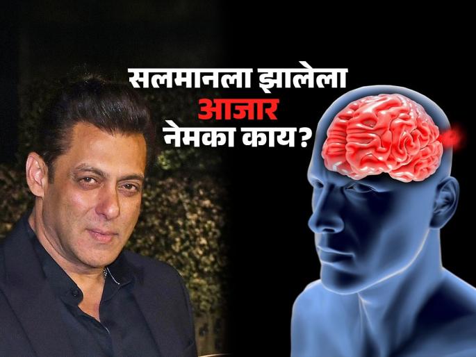 What is brain aneurysm disease which bollywood actor salman khan is struggling | सलमान खानला झालेला Brain Aneurysm आजार नेमका काय? लक्षणं कोणती-कारणं काय..