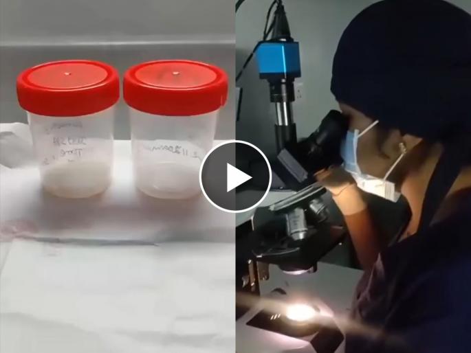 Doctor shows comparison of sperms of smoker and non smoker patients | डॉक्टरांनी मायक्रोस्कोपमधून दाखवला दोन व्यक्तींच्या स्पर्ममधील फरक, बघून सगळेच अवाक्... Doctor shows comparison of sperms of smoker and non smoker patients | डॉक्टरांनी मायक्रोस्कोपमधून दाखवला दोन व्यक्तींच्या स्पर्ममधील फरक, बघून सगळेच अवाक्...