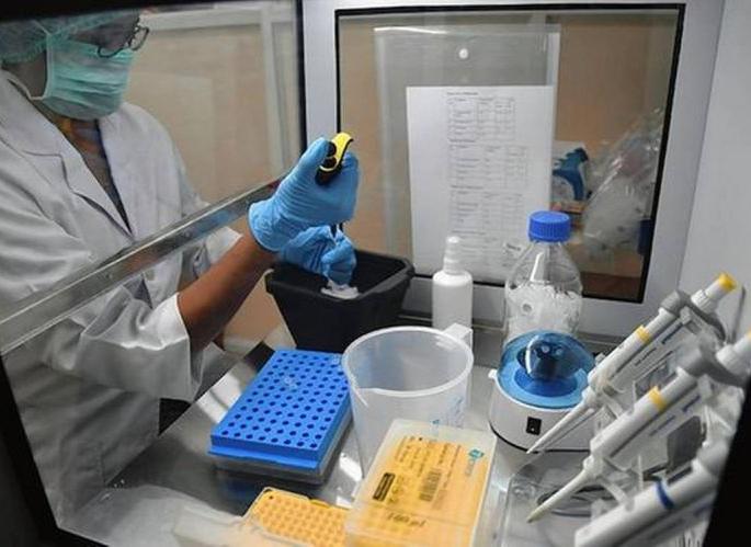 Samples pending for three days in VRDL Lab | व्हीआरडीएल लॅबमध्ये तीन दिवसांचे नमुने प्रलंबित Samples pending for three days in VRDL Lab | व्हीआरडीएल लॅबमध्ये तीन दिवसांचे नमुने प्रलंबित