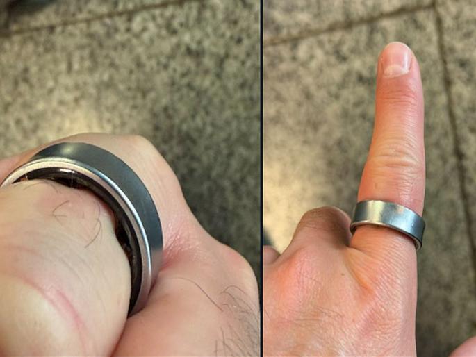 How dangerous is it? Samsung's smart ring battery swells, punctures finger; User sent straight from airport to hospital | किती धोक्याची? सॅमसंगची स्मार्ट रिंग बॅटरी फुगली, बोटात खुपली; वापरकर्ता विमानतळावरून थेट हॉस्पिटलमध्ये How dangerous is it? Samsung's smart ring battery swells, punctures finger; User sent straight from airport to hospital | किती धोक्याची? सॅमसंगची स्मार्ट रिंग बॅटरी फुगली, बोटात खुपली; वापरकर्ता विमानतळावरून थेट हॉस्पिटलमध्ये