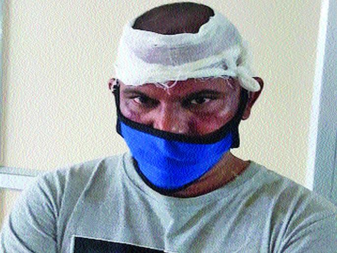 Complaint from Shiv Sena corporator after earlier beating | शिवसेनेच्या नगरसेविकांकड़ून आधी मारहाणनंतर तक्रार; विनयभंगाचा आरोप Complaint from Shiv Sena corporator after earlier beating | शिवसेनेच्या नगरसेविकांकड़ून आधी मारहाणनंतर तक्रार; विनयभंगाचा आरोप